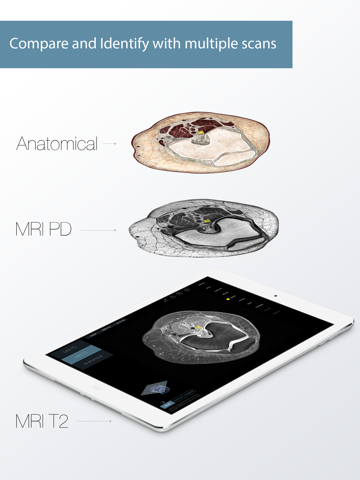 Radiology - Knee screenshot 2