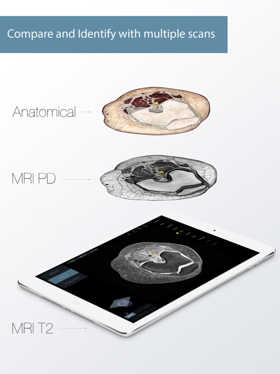 Radiology - Knee screenshot-1