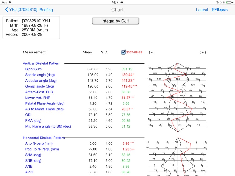 Smart V-Ceph screenshot-3