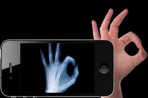 X ray lite for iPhone screenshot 2