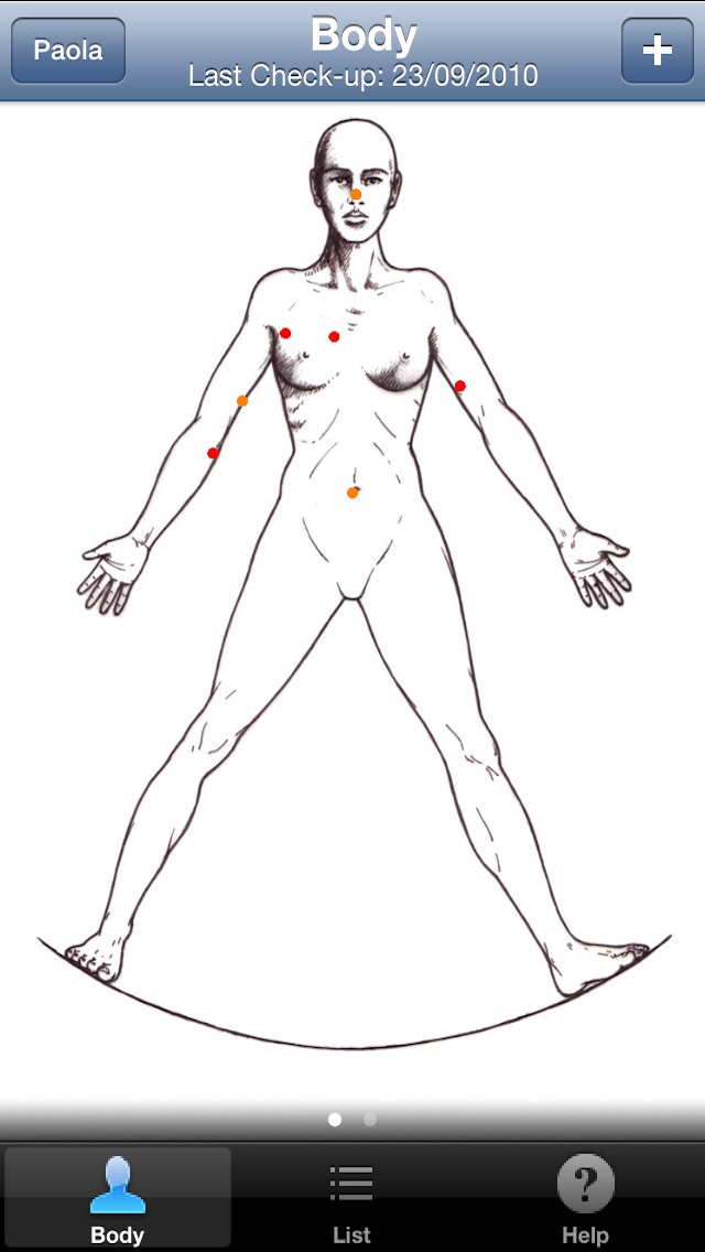 Skin Prevention – Photo Body Map for Melanoma and Skin Cancer early detection Screenshot 2