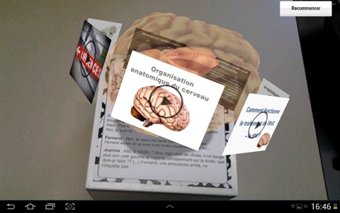 Cerebro screenshot 2