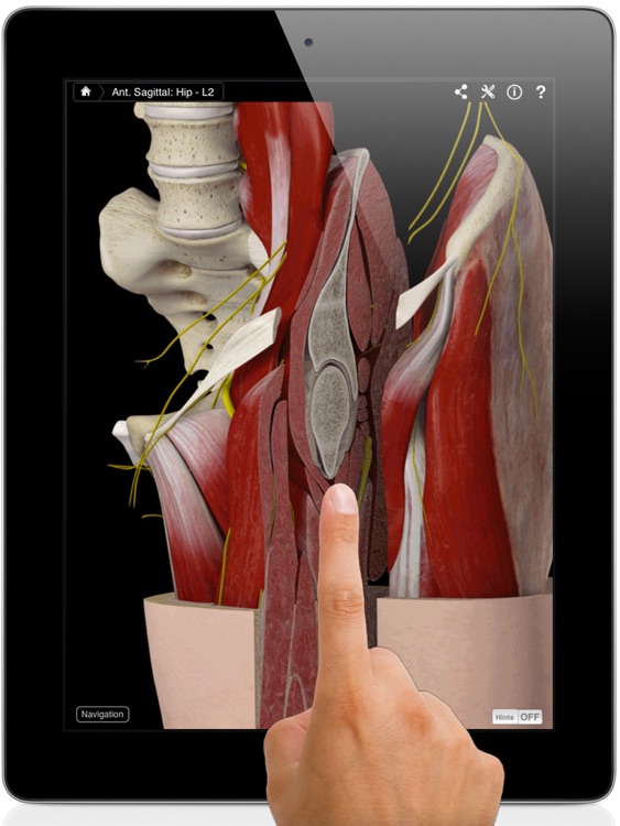 Hip Pro III for iPad screenshot-0