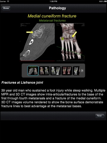 CTisus: CT of the Foot screenshot 4