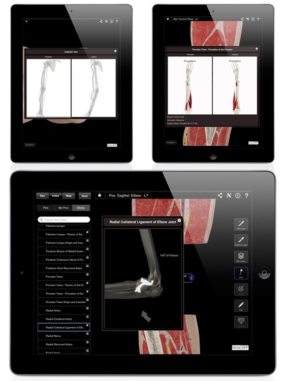Elbow Pro III for iPad screenshot-4