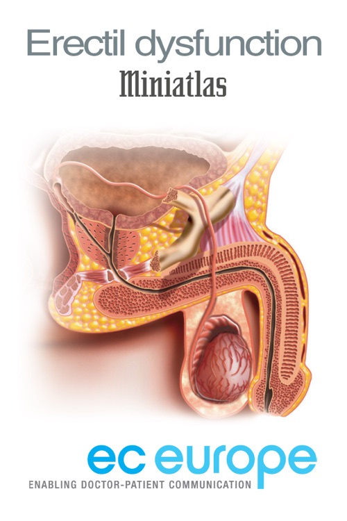 Miniatlas Erectile Dysfunction