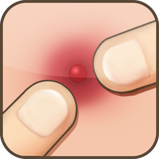 Pimple Popper iOS App