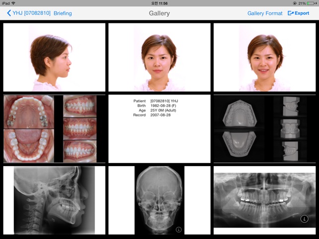 Smart V-Ceph(圖5)-速報App