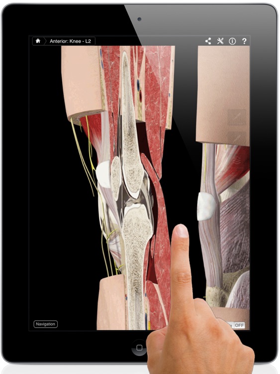 Knee Pro III for iPad screenshot-0