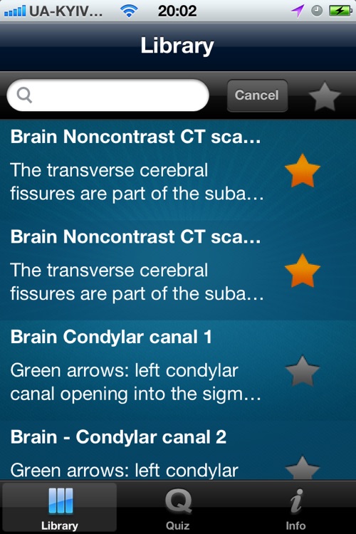 CT Scan