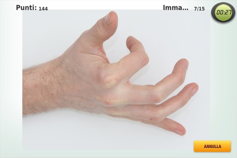 Limbs by Dr. Becker screenshot 3