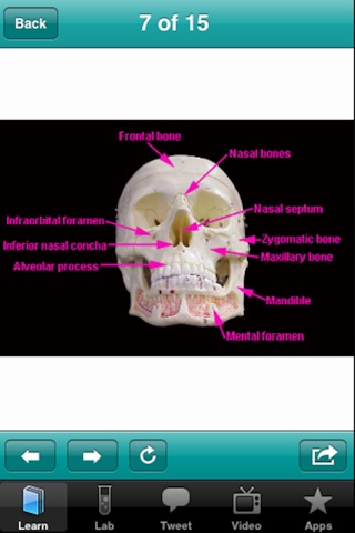 The Musculoskeletal System screenshot 4
