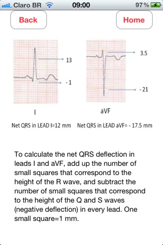 ECG Axis screenshot 3