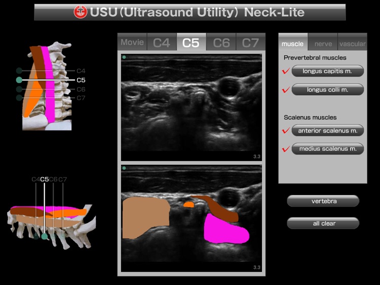 USU neck-lite