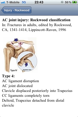 ShoulderClassification screenshot 3