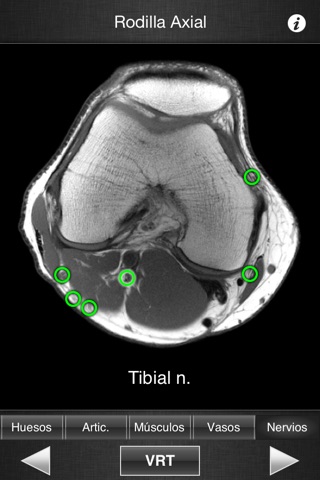 Monster Anatomy Lite - Knee screenshot 2