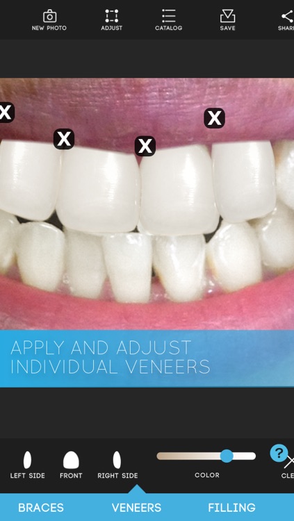 Virtual Dentist