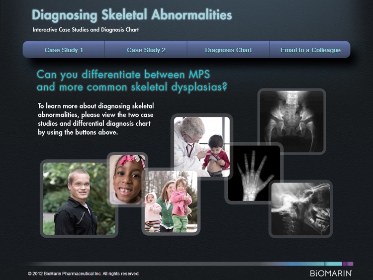 MPS Differential Diagnosis