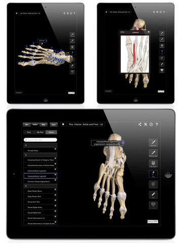 Ankle & Foot Pro III for iPad screenshot 4