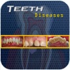 Teeth Diseases v1