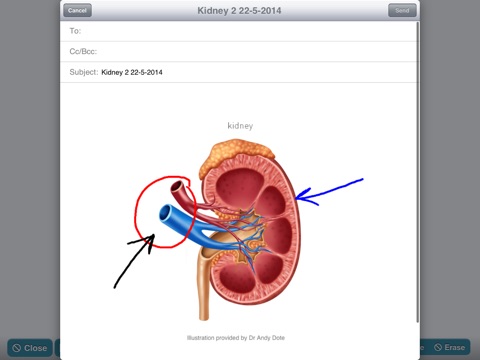 SurgiSketch screenshot 4