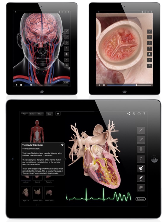 Heart Pro III