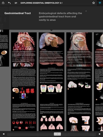 Exploring Essential Embryology screenshot 3