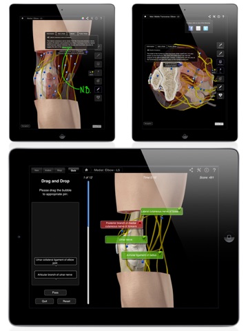 Elbow Pro III for iPad screenshot 3