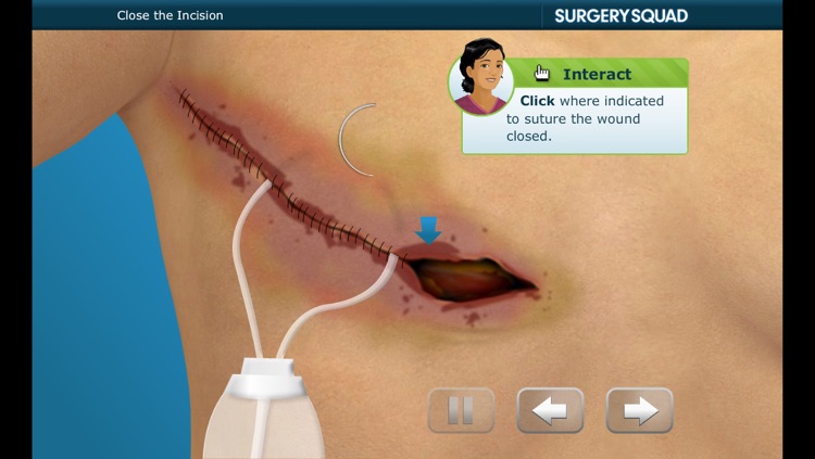 Surgery Squad's Mastectomy