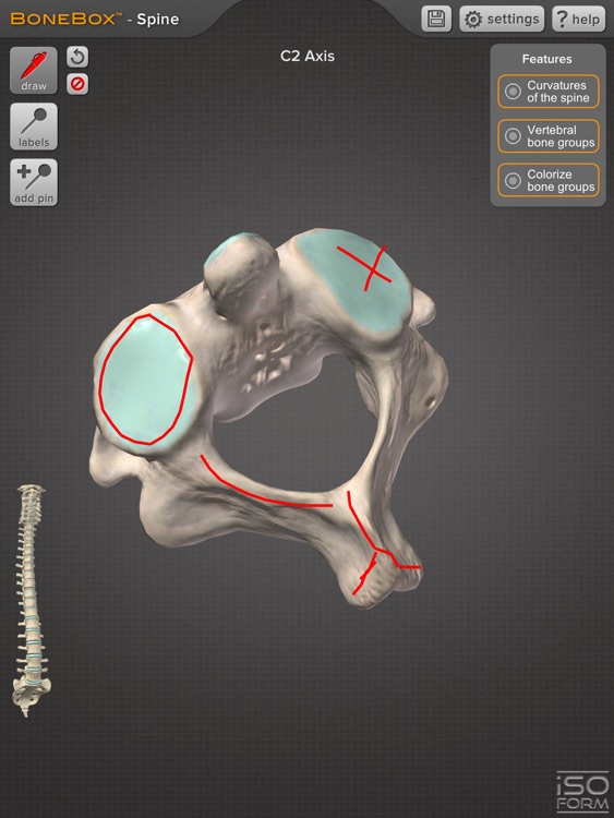 BoneBox™ - Spine Viewer screenshot-3