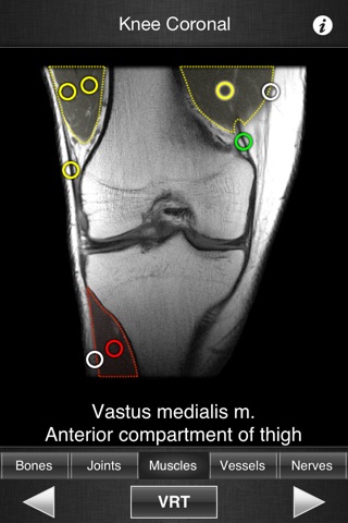 Monster Anatomy Lite - Knee screenshot 4