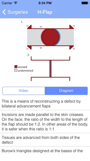 Surgical Flaps(圖2)-速報App