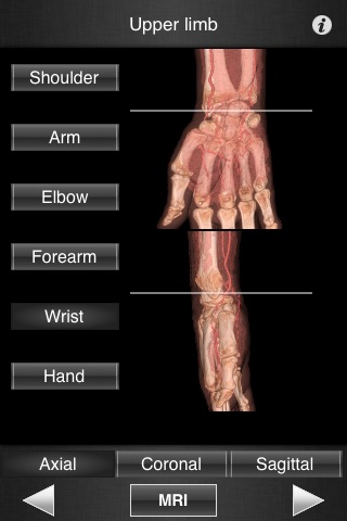 Monster Anatomy - Upper Limb