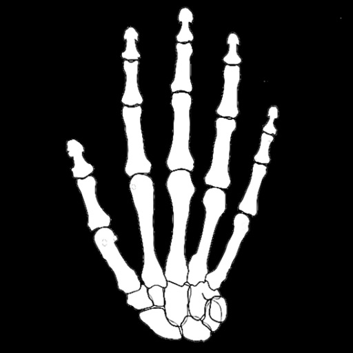 Exploring Anatomy: Bones of the Hand