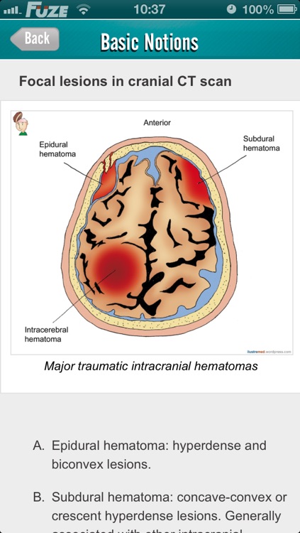Traumatic Brain Injury (TBI) screenshot-4