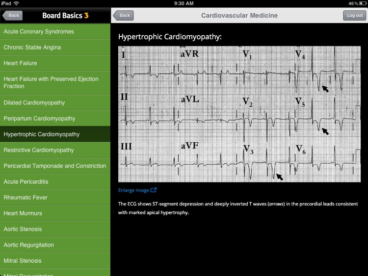 Board Basics 3 screenshot-3