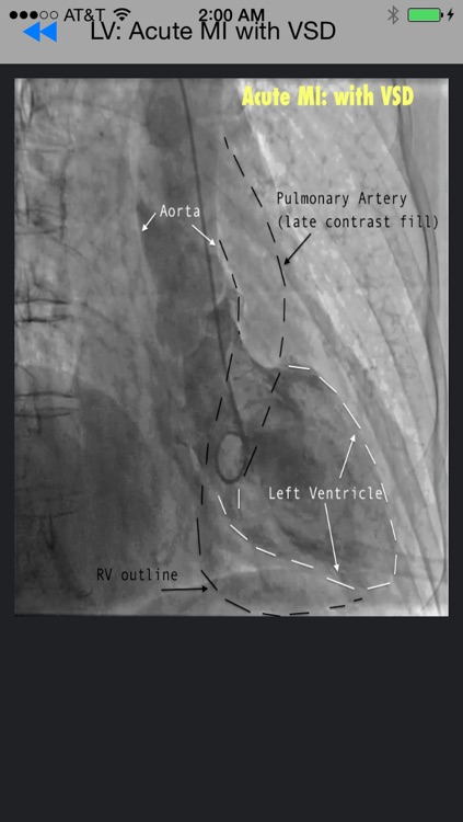 CathLab App