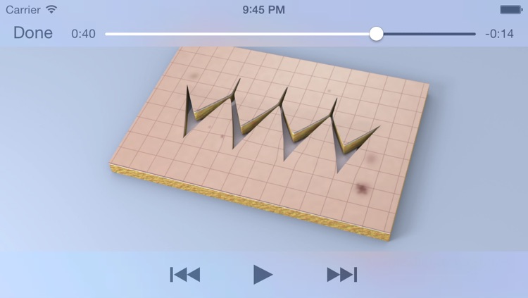 Surgical Flaps screenshot-4