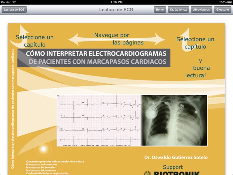 Lectura de ECG