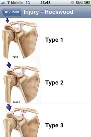 ShoulderClassification screenshot 2