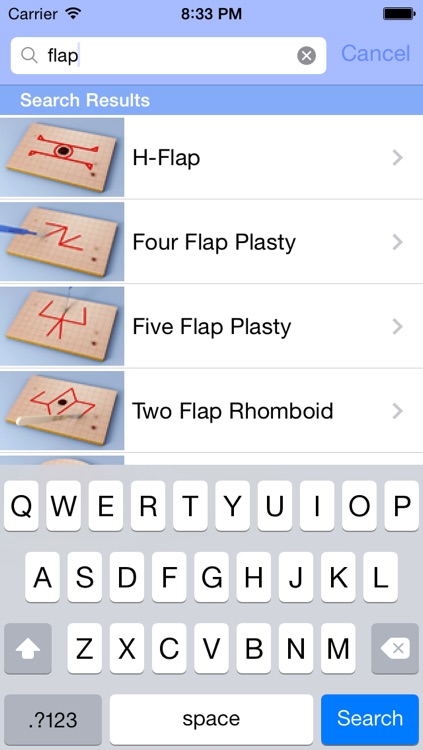 Surgical Flaps screenshot-3