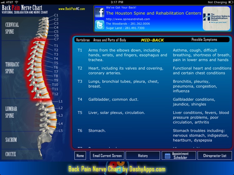 Back Pain Nerve Chart