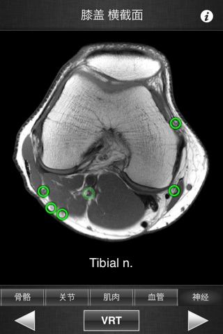 Monster Anatomy Lite - Knee screenshot 2