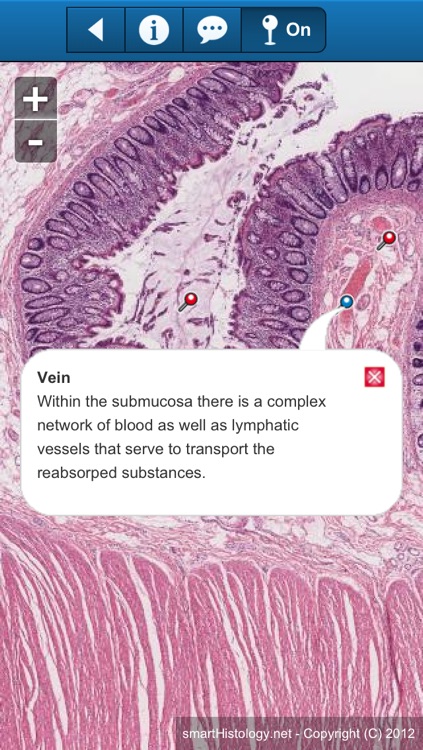 smart Histology screenshot-3