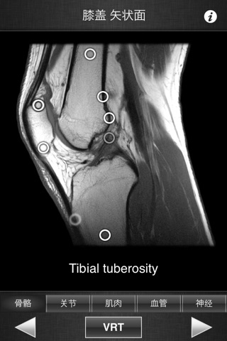 Monster Anatomy Lite - Knee screenshot 3