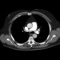 Chest Radiology Flashcards was designed for radiology resident and chest radiology fellowship education