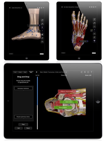 Ankle & Foot Pro III for iPad screenshot 3