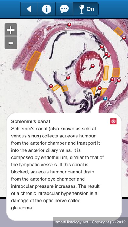 smart Histology