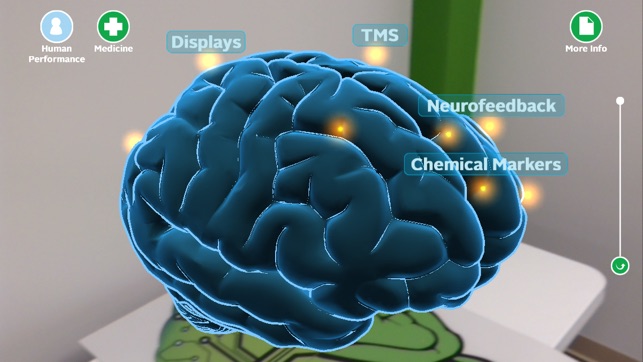 Wright State Brain Scan(圖2)-速報App