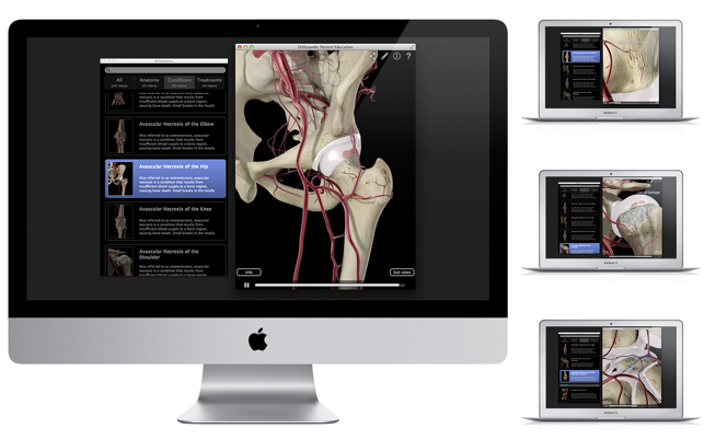 Orthopedic Patient Education(圖2)-速報App